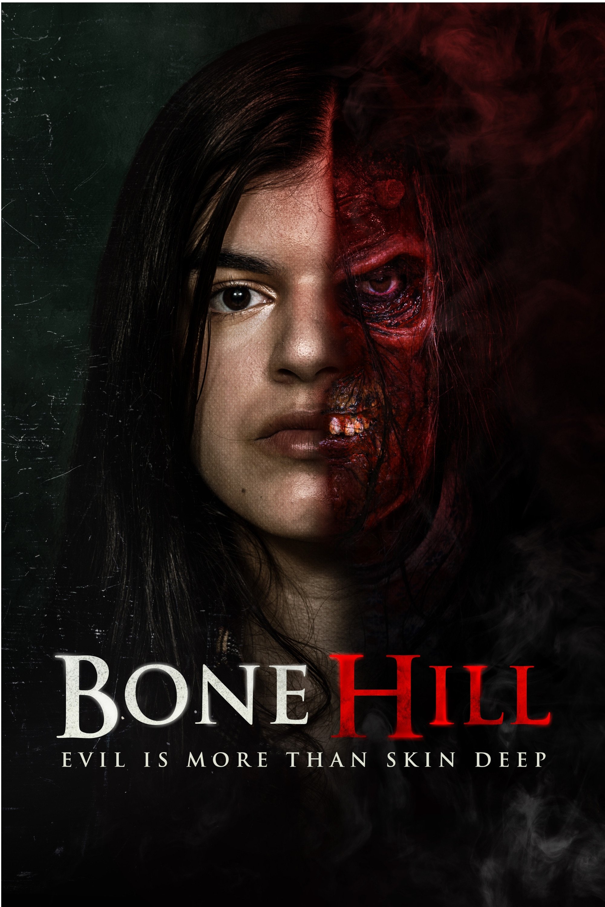 Bone Hill